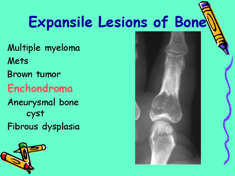 Multiple myeloma  Mets Brown tumor Enchondroma Aneurysmal bone cyst Fibrous dysplasia  Expansile